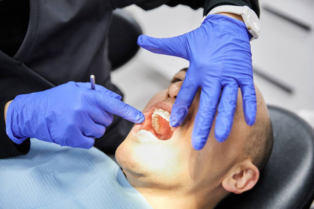 Best Emergency Wisdom Teeth Removal in Hampton, IL