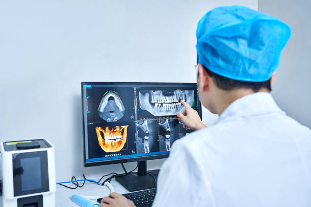 Best Emergency Tooth Extraction in Hampton, IL